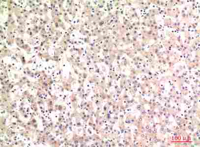 a01095 c4a primary antibodyes ihc testing 2