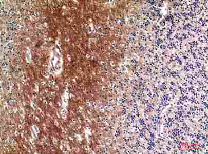 a01095 c4a primary antibodyes ihc testing 3