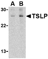 Western Blot Validation in Human Jurkat Cell Line
Loading: 15 μg of lysates per lane