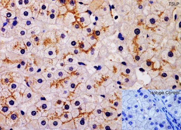 a01096 3 tslp primary antibodies ihc testing 1