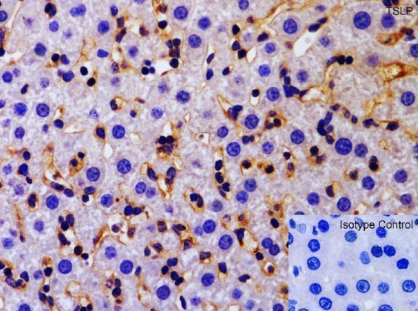 a01096 3 tslp primary antibodies ihc testing 2