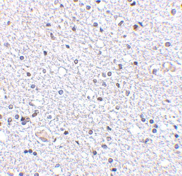 a01096 3 tslp primary antibodies ihc testing 5