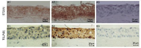 Induced Expression Validation of TSLP in Human Corneal Tissues (Lin et al