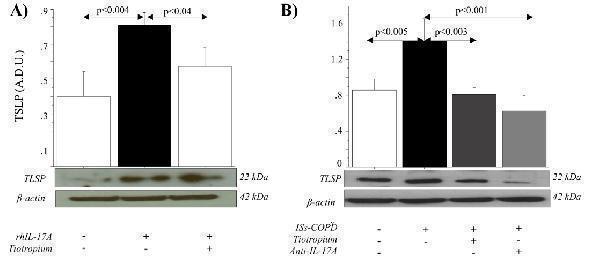 Regulated Expression Validation of TSLP in COPD Patients