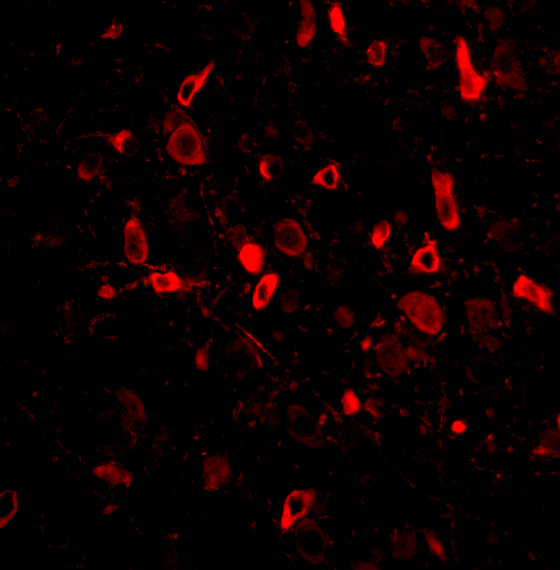 Immunofluorescence Validation of TSLP in Mouse Brain Tissue
Immunofluorescent analysis of 4% paraformaldehyde-fixed Mouse Brain Tissue labeling TSLP with A01096-4 at 20 μg/mL, followed by goat anti-rabbit IgG secondary antibody at 1/500 dilution (red)