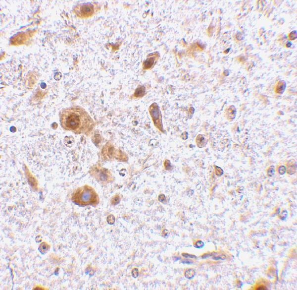 Immunohistochemistry Validation of TSLP in Mouse Brain Tissue  
Immunohistochemical analysis of paraffin-embedded Mouse Brain Tissue using anti-TSLP antibody (A01096-4) at 2