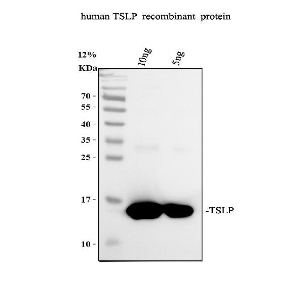 Western blot analysis of TSLP using anti-TSLP antibody (A01096)