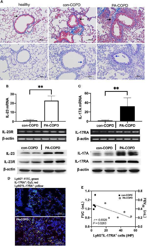 a01097 1 fimmu 12 811803 g002