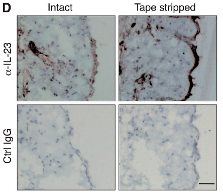 a01097 2 il23a primary antibodies ihc testing 6