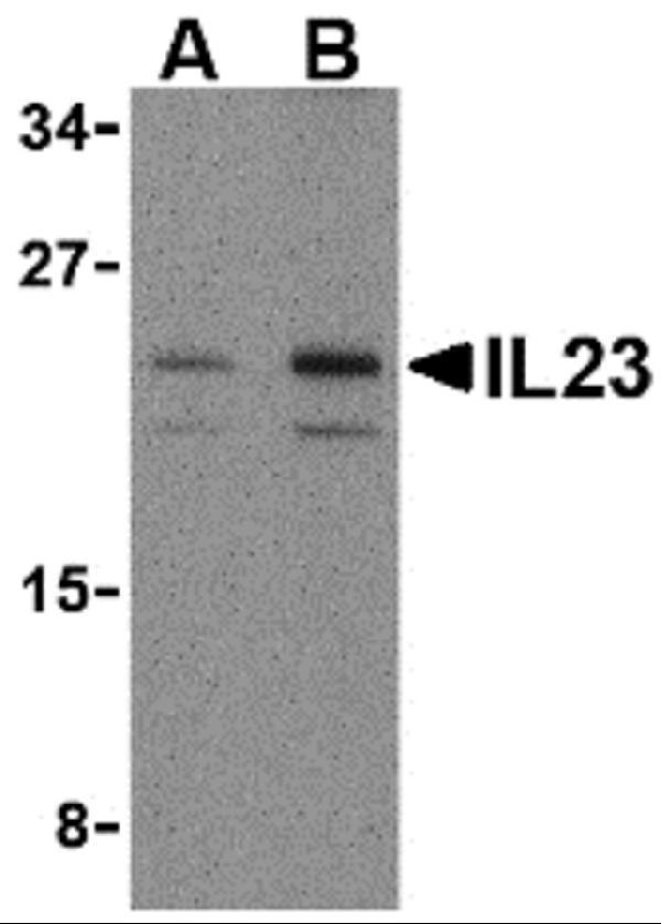 Western Blot Validation in Mouse Pancreas Tissue Lysate
Loading: 15 μg of lysates per lane