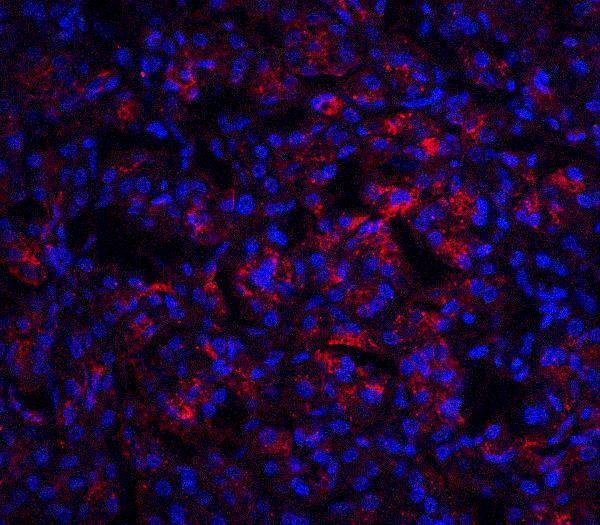 a01097 il23a primary antibodies if testing 6