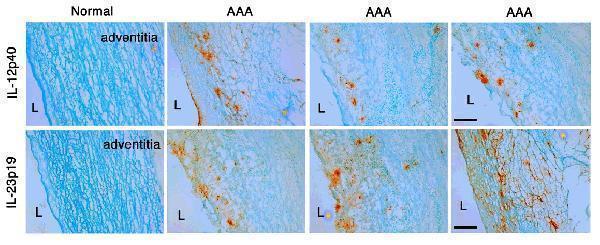 a01097 il23a primary antibodies ihc testing 8