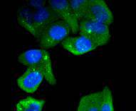 ICC staining C/EBP Beta in Hela cells (green)