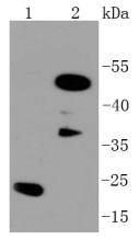Western blot analysis of C/EBP Beta on different lysates using anti-C/EBP Beta antibody at 1/1,000 dilution