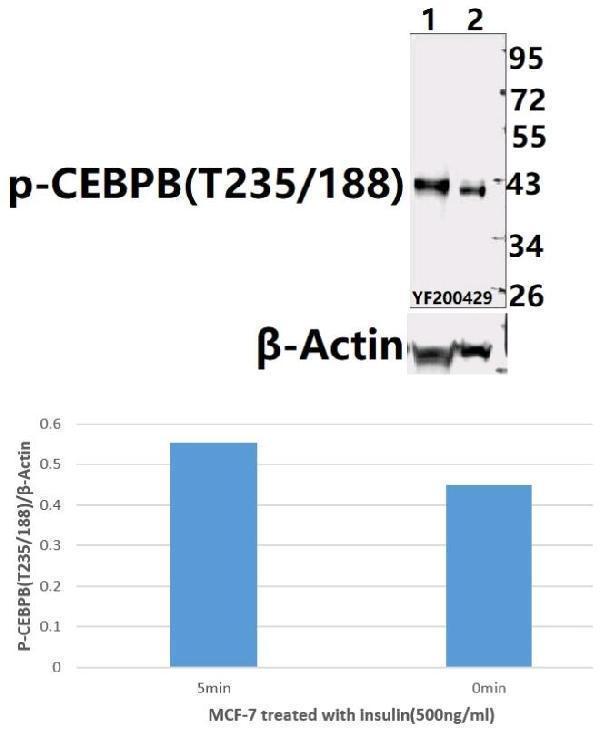 Western blot (WB) analysis of C/EBP-β (phospho-T235/188) pAb at 1:500 dilution
Lane1:MCF-7 treated with insulin(500ng/ml,5min) whole cell lysate(40ug)
Lane2:MCF-7 treated with insulin(500ng/ml,0min) whole cell lysate (40ug)