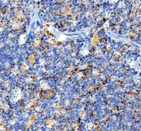  IHC analysis of CD41/Integrin Alpha 2B/ITGA2B using anti-CD41/Integrin Alpha 2B/ITGA2B antibody (A01102-1)