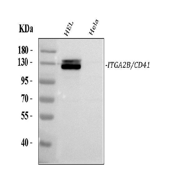  Western blot analysis of CD41/Integrin Alpha 2B/ITGA2B using anti-CD41/Integrin Alpha 2B/ITGA2B antibody (A01102-1)