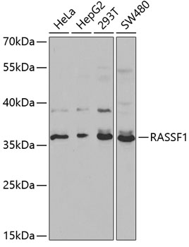 Western blot analysis of extracts of various cell lines, using RASSF1 antibody  at 1:1000 dilution