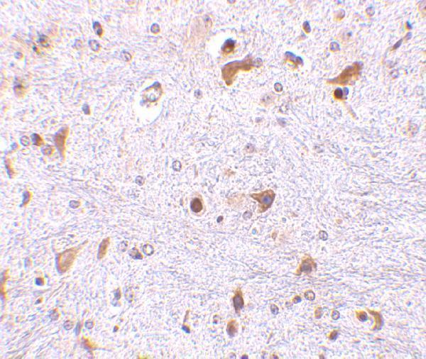 a01105 1 pdcd4 primary antibodies ihc testing 2