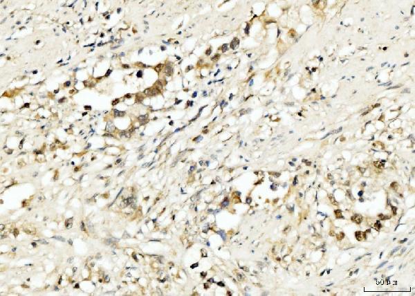 a01105 pdcd4 primary antibodies ihc testing 2