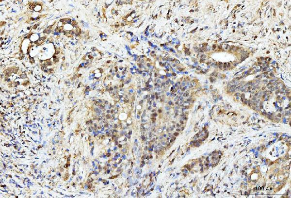 a01105 pdcd4 primary antibodies ihc testing 3