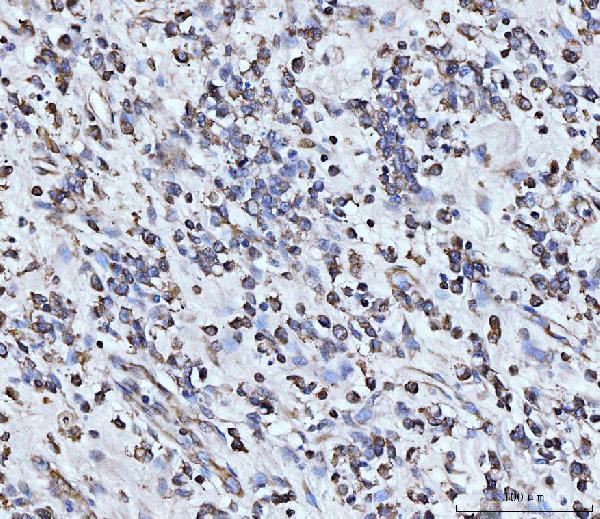 a01105 pdcd4 primary antibodies ihc testing 4