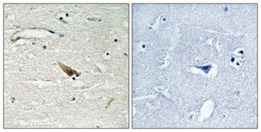 a01105s67 pdcd4 primary antibodies ihc testing 1