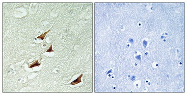 a01105s67 pdcd4 primary antibodies ihc testing 3