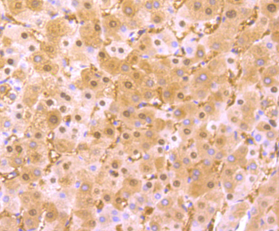 Immunohistochemical analysis of paraffin-embedded human liver tissue using anti-Liver Arginase antibody
