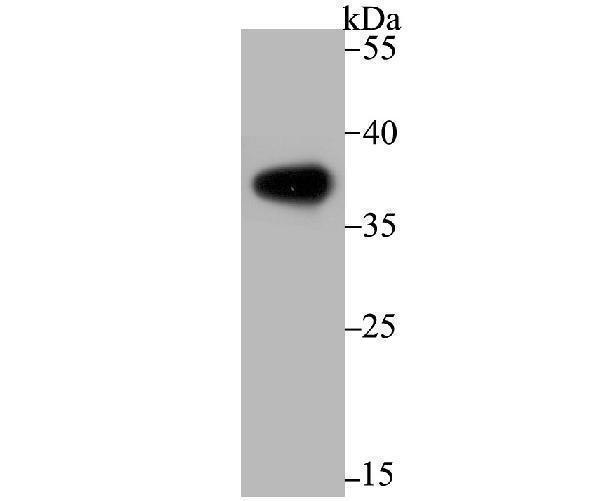 Western blot analysis of Liver Arginase on human liver tissue lysate using anti-Liver Arginase antibody at 1/500 dilution