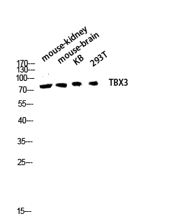 Western blot analysis of mouse-kidney mouse-brain KB 293T lysis using TBX3 antibody