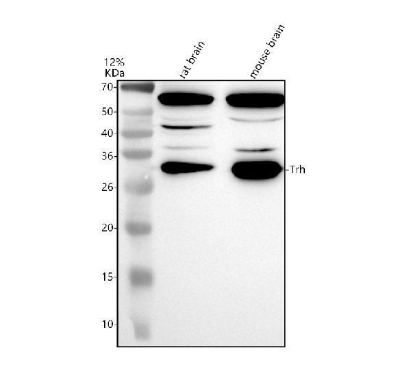 Western blot analysis of Trh using anti-Trh antibody (A01108-2)