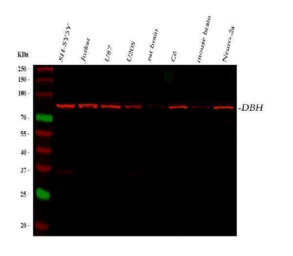 a01110 dbh primary antibodies wb testing 1