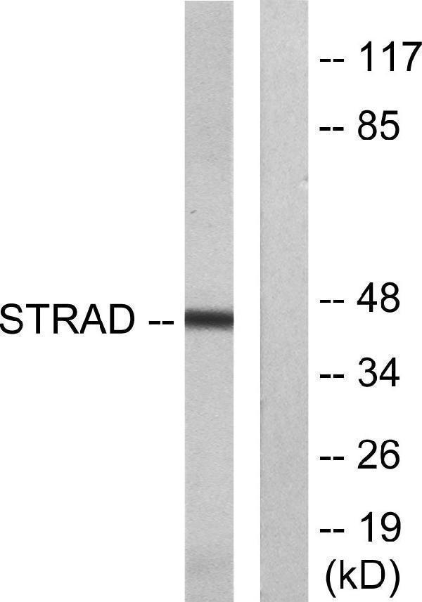 Western blot analysis of lysates from HepG2 cells, using STRAD Antibody