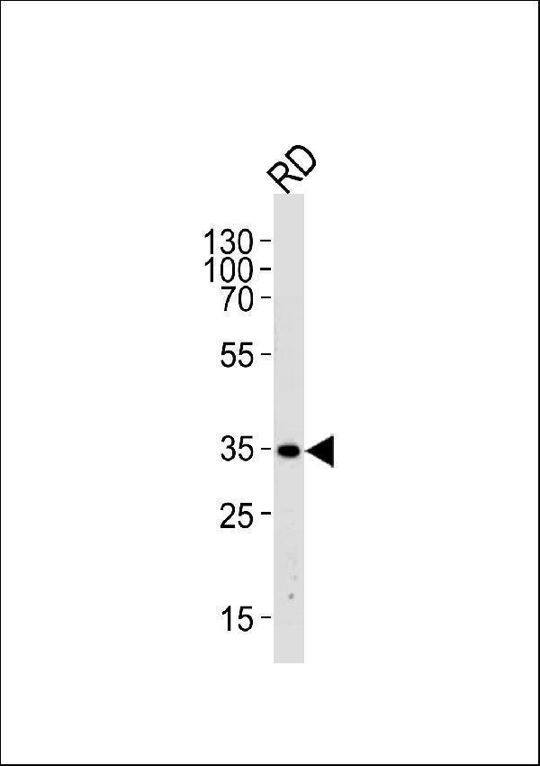 Western blot analysis of lysate from RD cell line,using EDA Antibody (N-term)