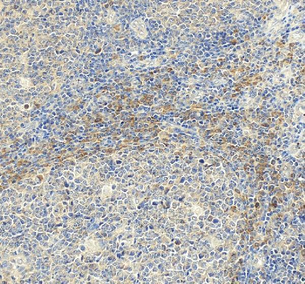 IHC analysis of CD154/CD40LG using anti-CD154/CD40LG antibody (A01114-2)