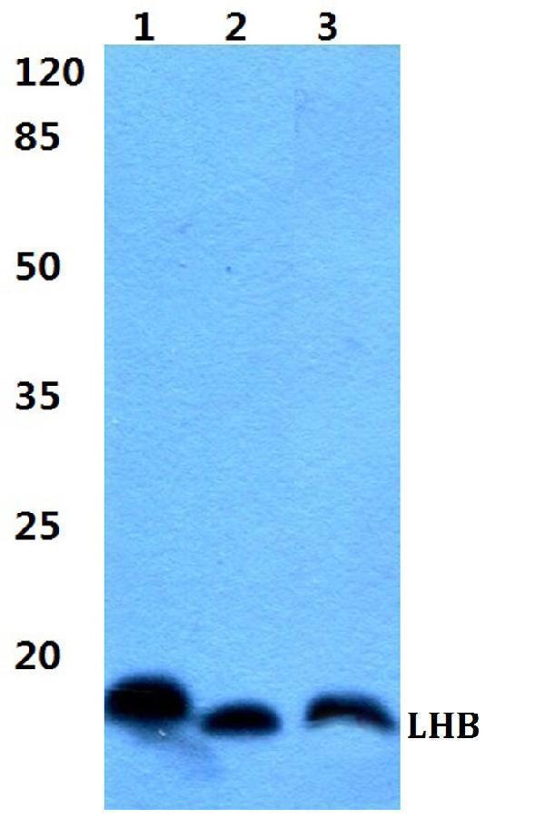 Western blot (WB) analysis of LHB polyclonal antibody at 1:500 dilution
Lane1:HEK293T cell lysate
Lane2:sp2/0 cell lysate
Lane3:PC12 cell lysate