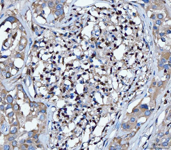  IHC analysis of PU