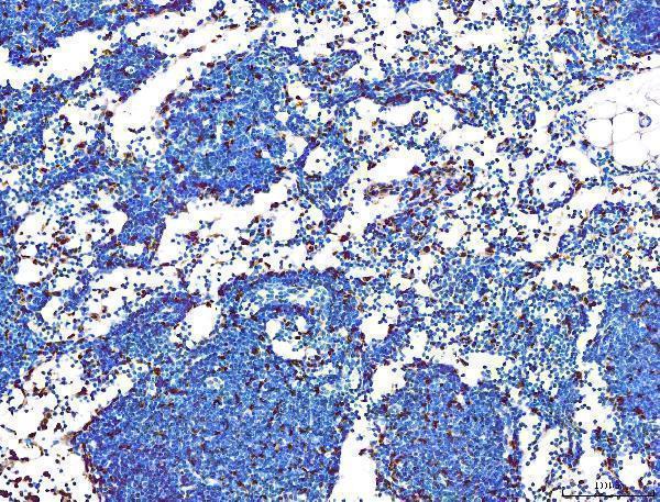  IHC analysis of PU
