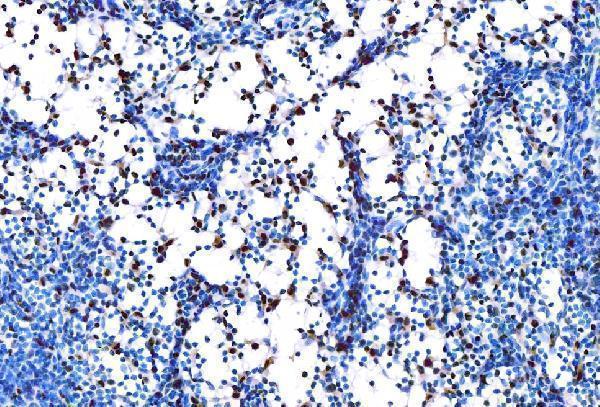 a01116 1 spi1 primary antibodies ihc testing 4