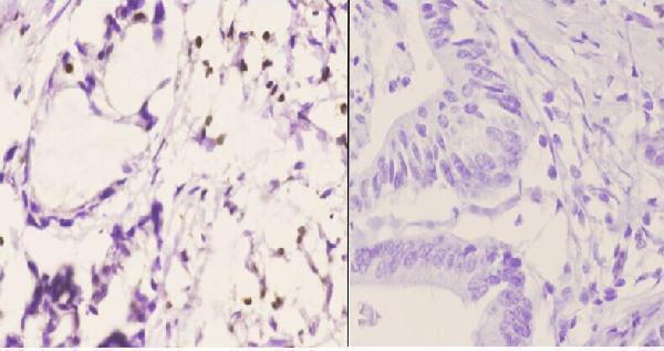 a01116 spi1 primary antiboties ihc testing 2