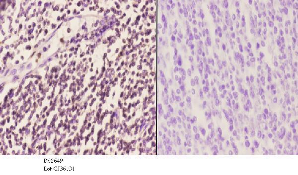 a01116 spi1 primary antiboties ihc testing 3