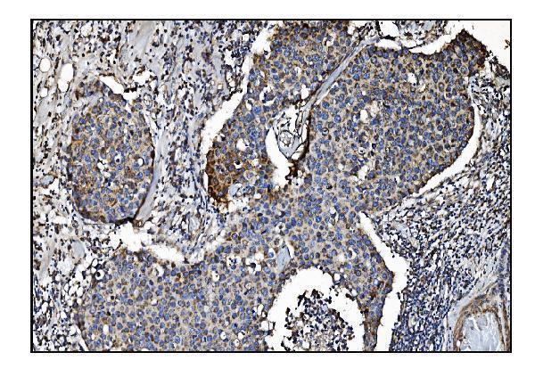 a01117 1 clpp primary antibodies ihc testing 2
