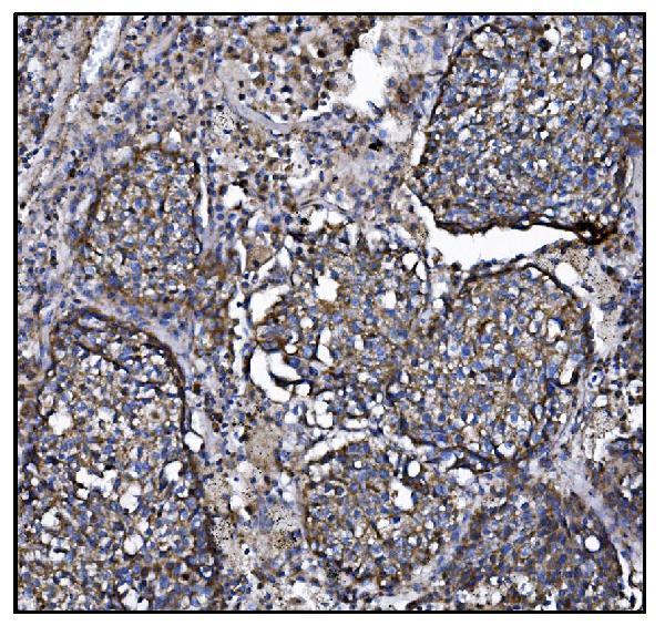 a01117 1 clpp primary antibodies ihc testing 4