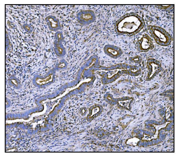 a01117 1 clpp primary antibodies ihc testing 6