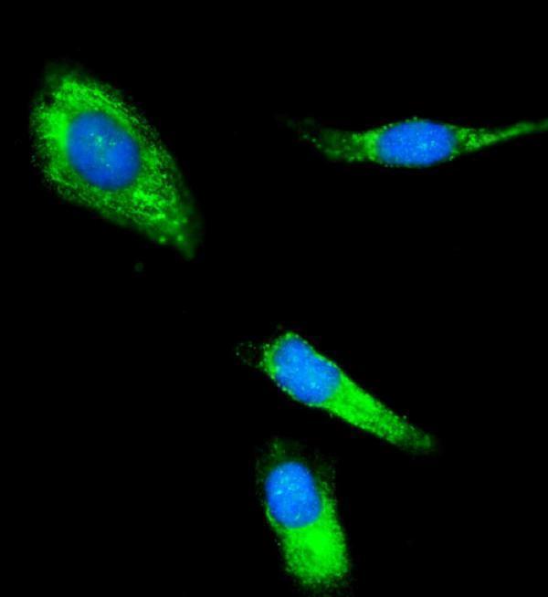  IF analysis of CLPP using anti-CLPP antibody (A01117-3)