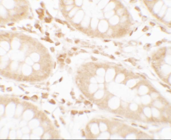 Immunohistochemistry of CRTC2 in human small intestine tissue with CRTC2 antibody at 2