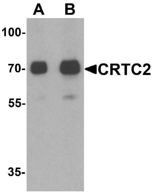 Western blot analysis of CRTC2 in human small intestine tissue lysate with CRTC2 antibody at (A) 0