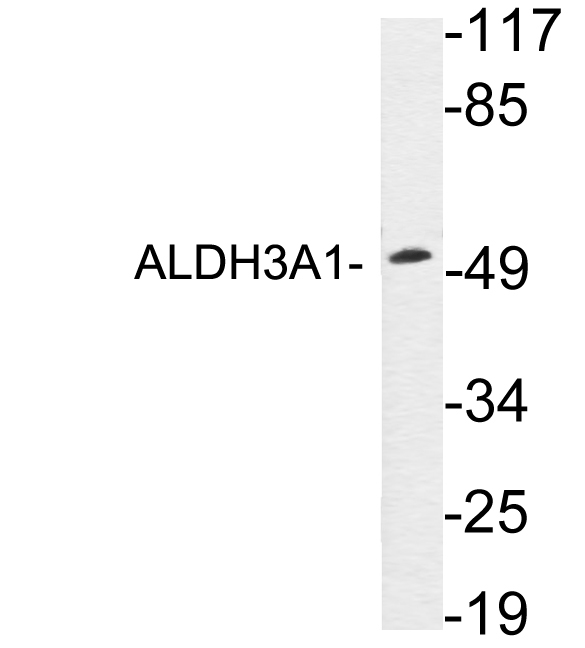 a01121 1 aldh3a1 primary antibodies wb testing 1