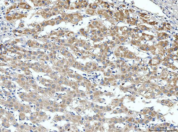  IHC analysis of ALDH3A1 using anti-ALDH3A1 antibody (A01121-4)